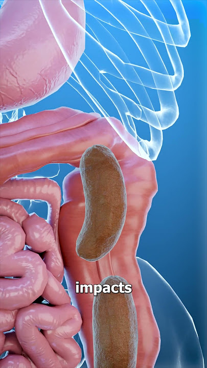 What Is Constipation? 💩