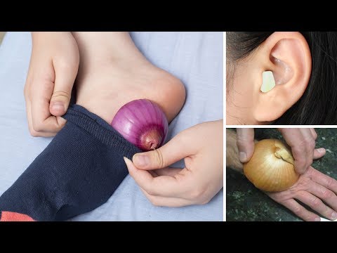 5 Health Conditions Onions Can Help You With