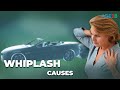 Causes of Whiplash: A Physical Therapy SECRET for Treating: How your body gets damaged in a whiplash