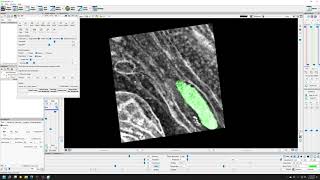 Viewing an EM stack and segmentation