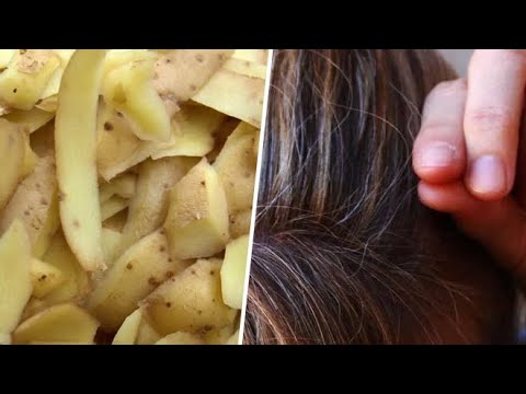 Video: A shkaktojnë thinje të parakohshme flokët e ngordhur?