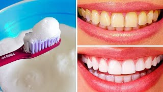 Teeth Whitening At Home In 3 Minutes || How To Whiten Your Yellow Teeth Naturally || 100% Effective