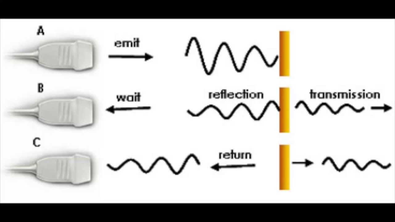 Ultrasound B-Mode Image Reconstruction 