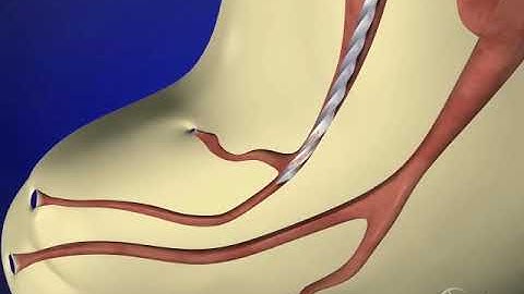 Glide Path Management - Reproducible Glide Path