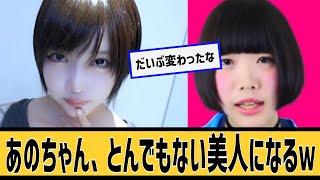あのちゃん、とんでもない美人にに対するネット民の反応＃2ch＃5ch＃なんｊ＃なんＧ