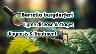 Borrelia burgdorferi | spirochetes | lyme disease | Microbiology