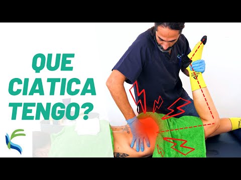 SCIATICA How many TYPES are there and how do they differ? Physiolution