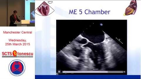 Transoesophageal echocardiography perioperative guidelines