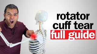Rotator Cuff Tear: Everything You Need To Know [FULL 2024 GUIDE]