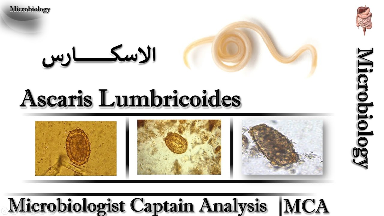 Ascaris Lumbricoides ديدان الاسكارس وتاثيرها على الكبد والرئة + الاعراض وطرق التشخيص