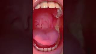 Vore Zoe Cắn Một Miếng