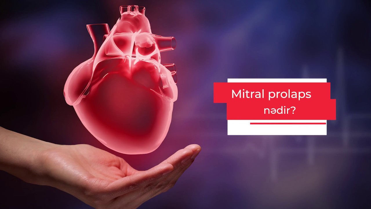 Mitral prolaps