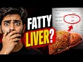  Fatty Liver का संकेत? | High SGOT ka karan | Liver test | Blood Report