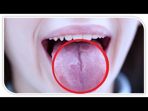 Video: Si të shpëtoni nga vlimi i çamçakëzit: 10 hapa (me fotografi)
