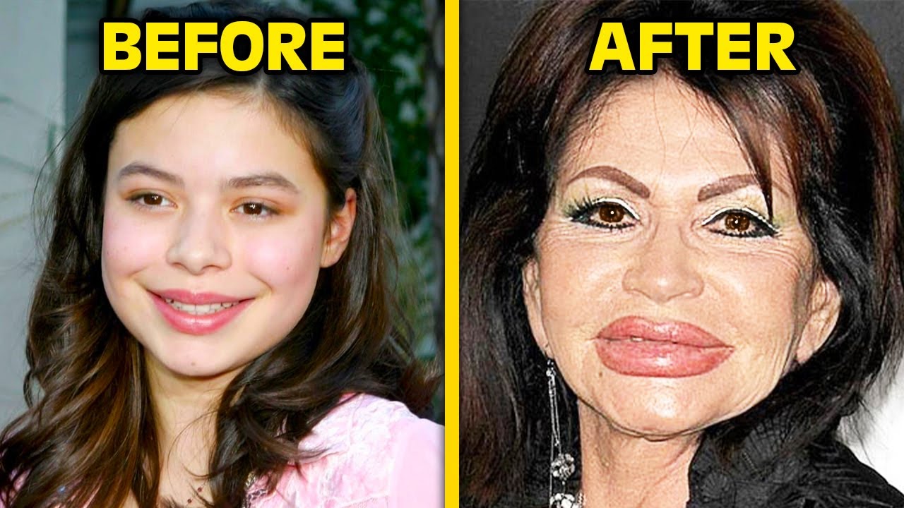 Celebrities Who REGRET Their Plastic Surgery