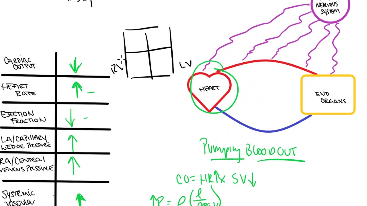 Cardiogenic Shock YouTube