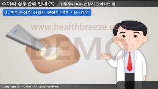 [Demonstration] g0067aako Pediatric Stoma Care Guide 3: Nursing and Complications