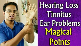 Acupressure points for all ear problems , hearing loss tinnitus pain
deafness - in hindidon't miss this video complete cure of t...