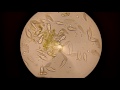Жизнь под микроскопом: инфузории-туфельки бьются за еду (Life under microscope: Paramecium)