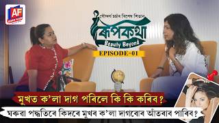 DARK SPOTS ON FACE? BEST HOME REMEDIES & GLOWING SKIN TIPS | RUPKOTHA BEAUTY BEYOND |ASSAM FLASH