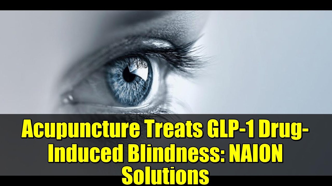 Acupuncture Treats GLP-1 Drug-Induced Blindness: NAION Solutions