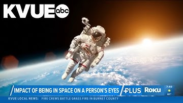 How space travel impacts the vision of nearsighted astronauts