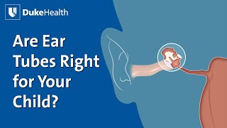 Does Your Child Need Ear Tubes? | Duke Health