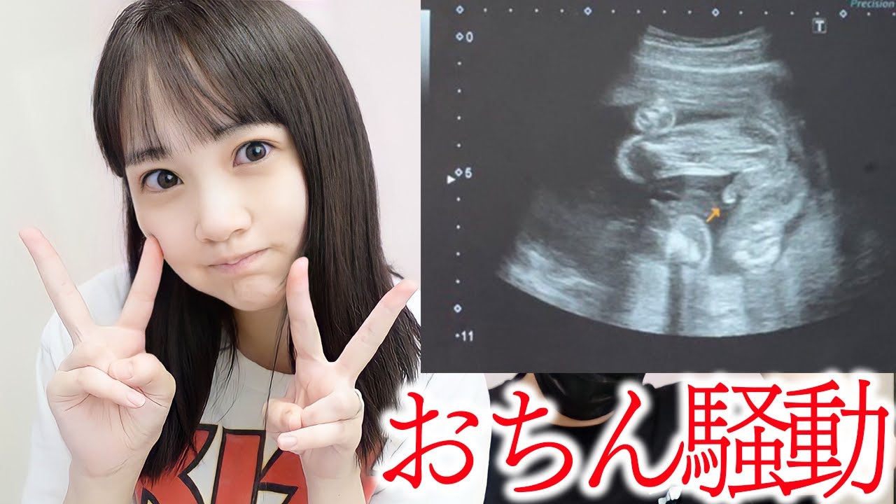 性別判明動画の おちん は勘違いでした 妊娠22週 Youtube