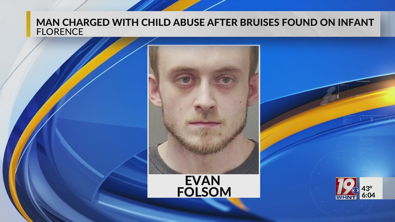 Florence Man Charged With Child Abuse After 'Bruises,' 'Dried Blood ...