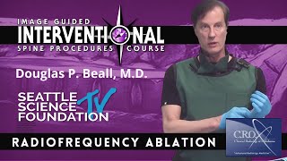 Radiofrequency Ablation  - Douglas P. Beall, M.D.