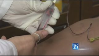 Tippecanoe Co. Health Dept. giving free STD screenings