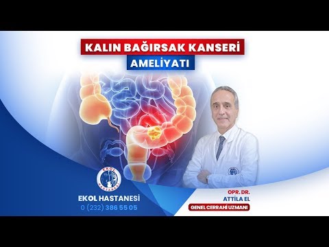İzmir Ekol Hastanesi - Kalın Bağırsak Kanseri Ameliyatı - Opr. Dr. Attila El
