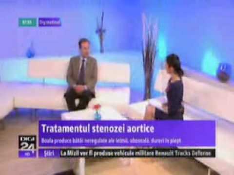 Video: Diferența Dintre Scleroza Aortică și Stenoza Aortică