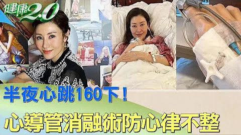 半夜心跳160下! 李嘉欣心導管消融術防心律不整 健康2.0 - 天天要聞