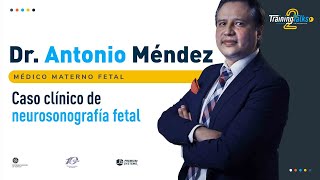 Día 4 - Caso clínico de neurosonografía fetal - Training Talks 2do aniversario 🎊 Día 4 - Caso clínico de neurosonografía fetal - Training Talks 2do aniversario 🎊