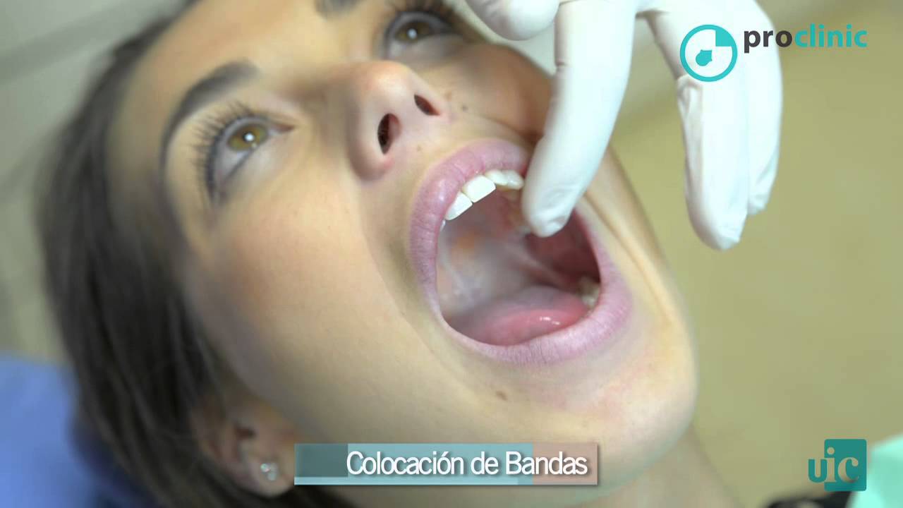 Cap. 19 - El material en ortodoncia