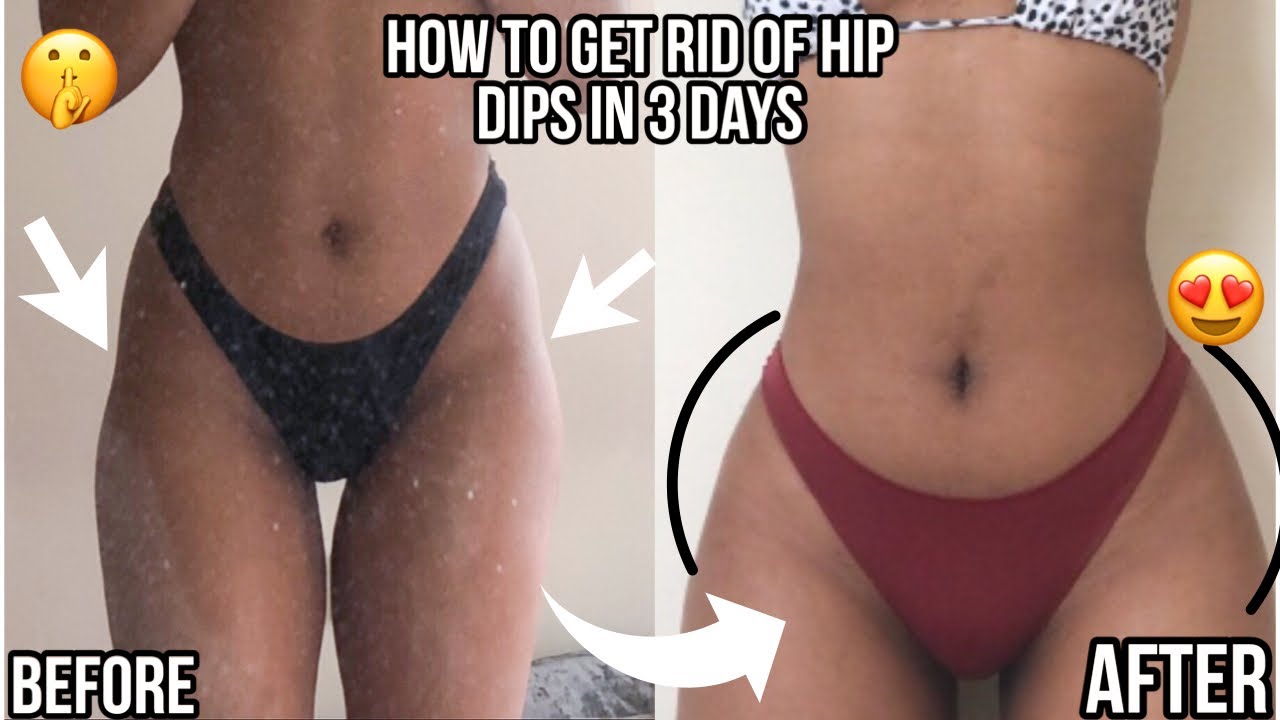 HOW TO GET RID OF HIP DIPS IN 5 DAYS!!! - A full set of workouts 