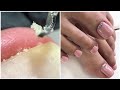 Most Satisfying Pedicure Transformation 😱 best nail polish for toes 2022