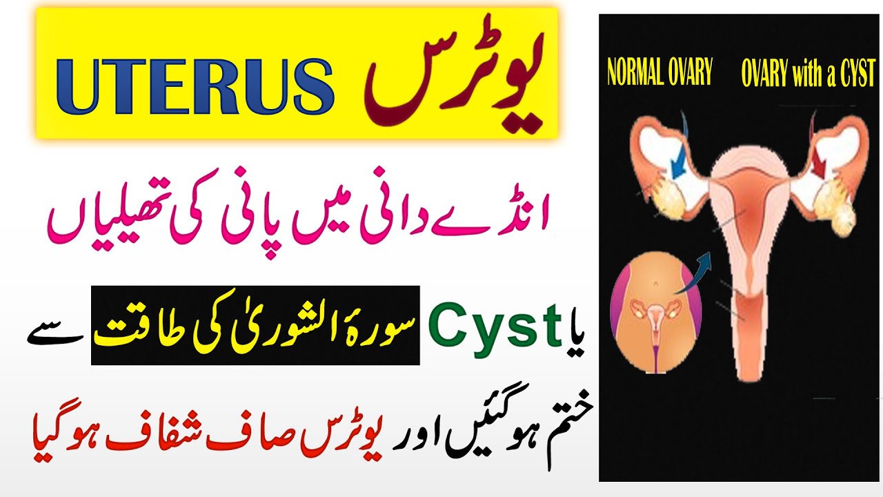 Uterus Mein Pani Ki Theli Ka Taweez Wazifa For Cyst In Ovary Uterus Ka Rohani Ilaj YouTube