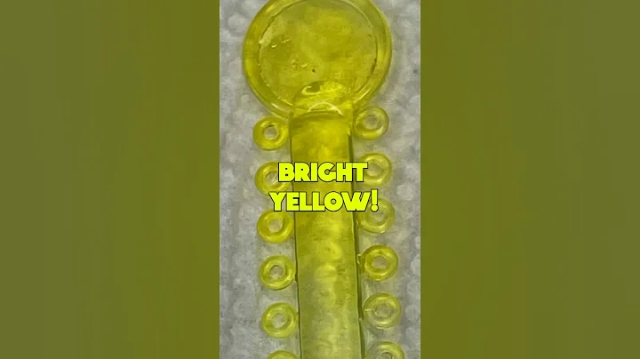 AVOID THIS SPICE OR YOUR BRACES TURN BRIGHT YELLOW! STOP BRACES COLORS STAINING ORTHODONTIST REACTS