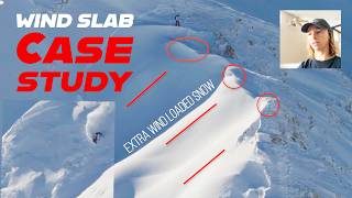 AVALANCHE CASE STUDY - WIND SLAB