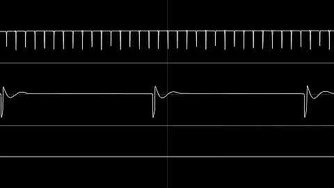 8-Bit Keys(The 8-Bit guy) - "Atari Junk Keyboard" SID 6581 Cover