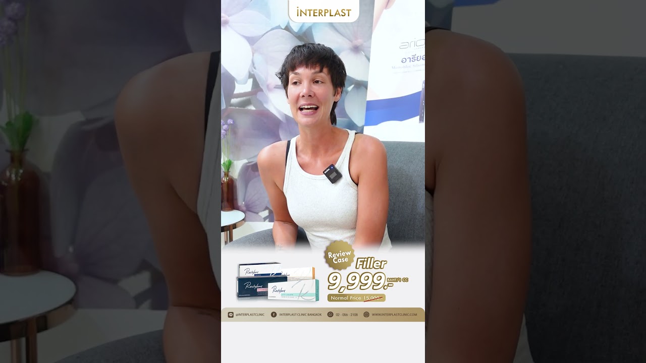 Dark circles under the eyes, bags, and wrinkles restoration with Restylane hyaluronic acid filler.