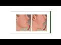 Introduction to human anatomy 3 anatomical movements Prof Mohey Hulail