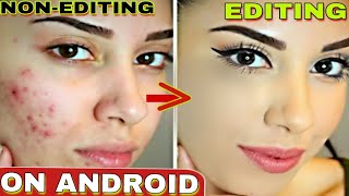 How To Rough And Pimple Face Clean With Pic Arts ? [ On Android phone ] {Photographer Series Start} screenshot 1