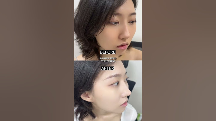 연예인들 얼굴은 왜 다 하얀걸까? #미백 #화장품 #기초케어 #미백크림 #추천