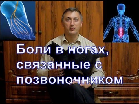 Боли в ногах 1. Связанные с позвоночником