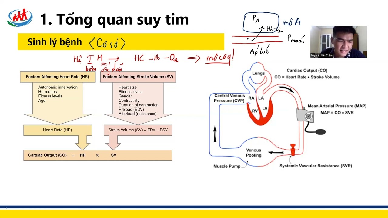 [ TIẾP CẬN SUY TIM ]