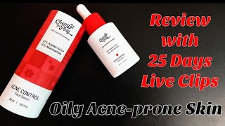 Chemist at play 10% Azelaic acid+10% Niacinamide Acne control serum |Review with 25 days live clips