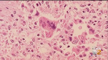 U.S. Measles Outbreak Now Largest Since Disease Declared Eliminated In 2000